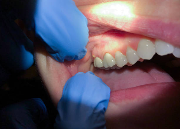 Best Emergency Dental Surgery in Chadbourn, NC